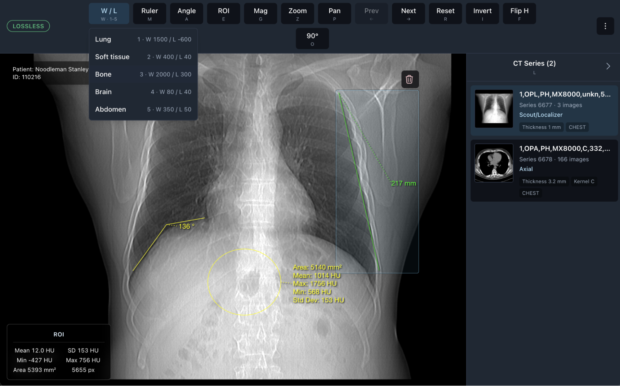 Photon PACS image viewer showing a radiology study.