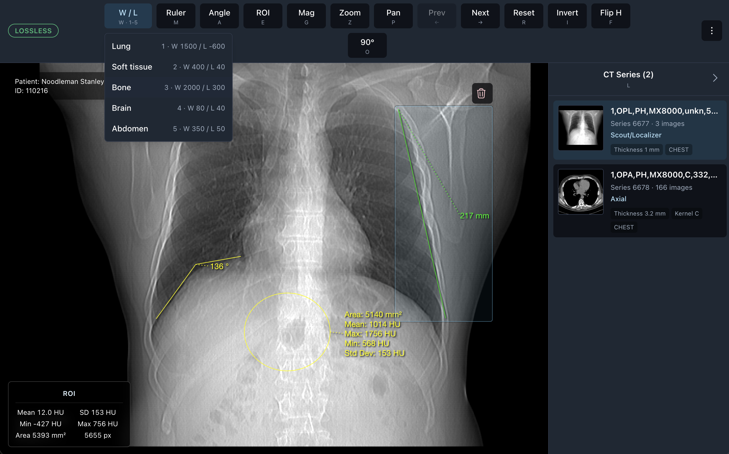 Photon viewer controls